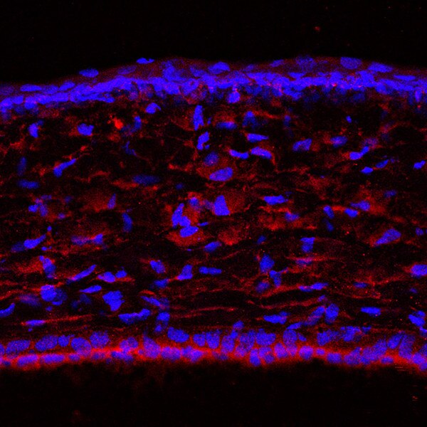 IF of a mouse cornea labeled with DSHB antibody PCRP-JAZF1-1C1 against JAZF zinc finger 1 (red). Image credit: Lachke Lab, University of Delaware.
